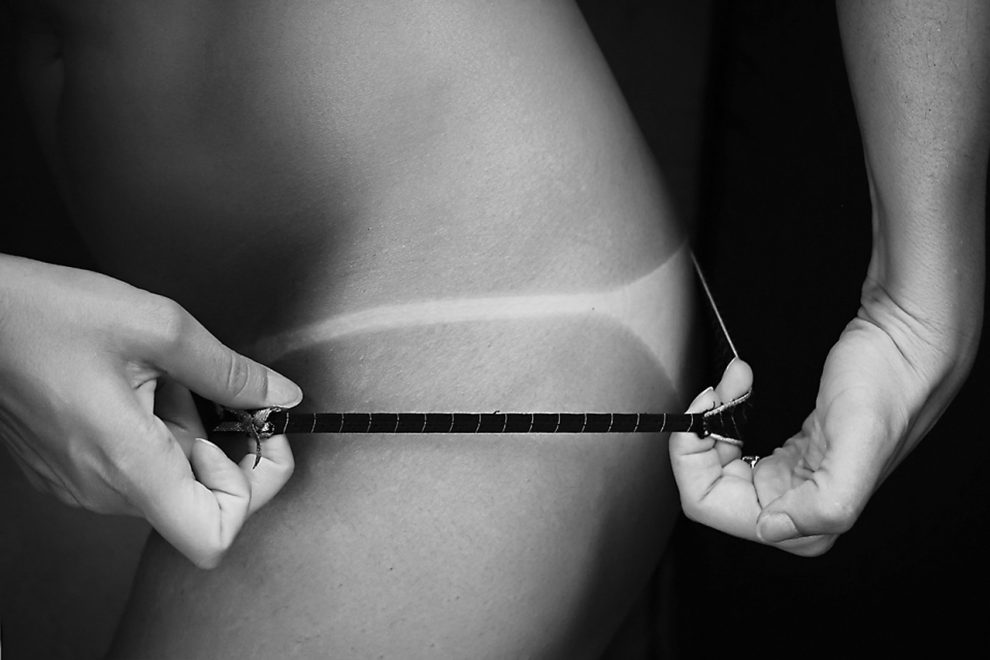remedii naturiste pentru arsurile solare